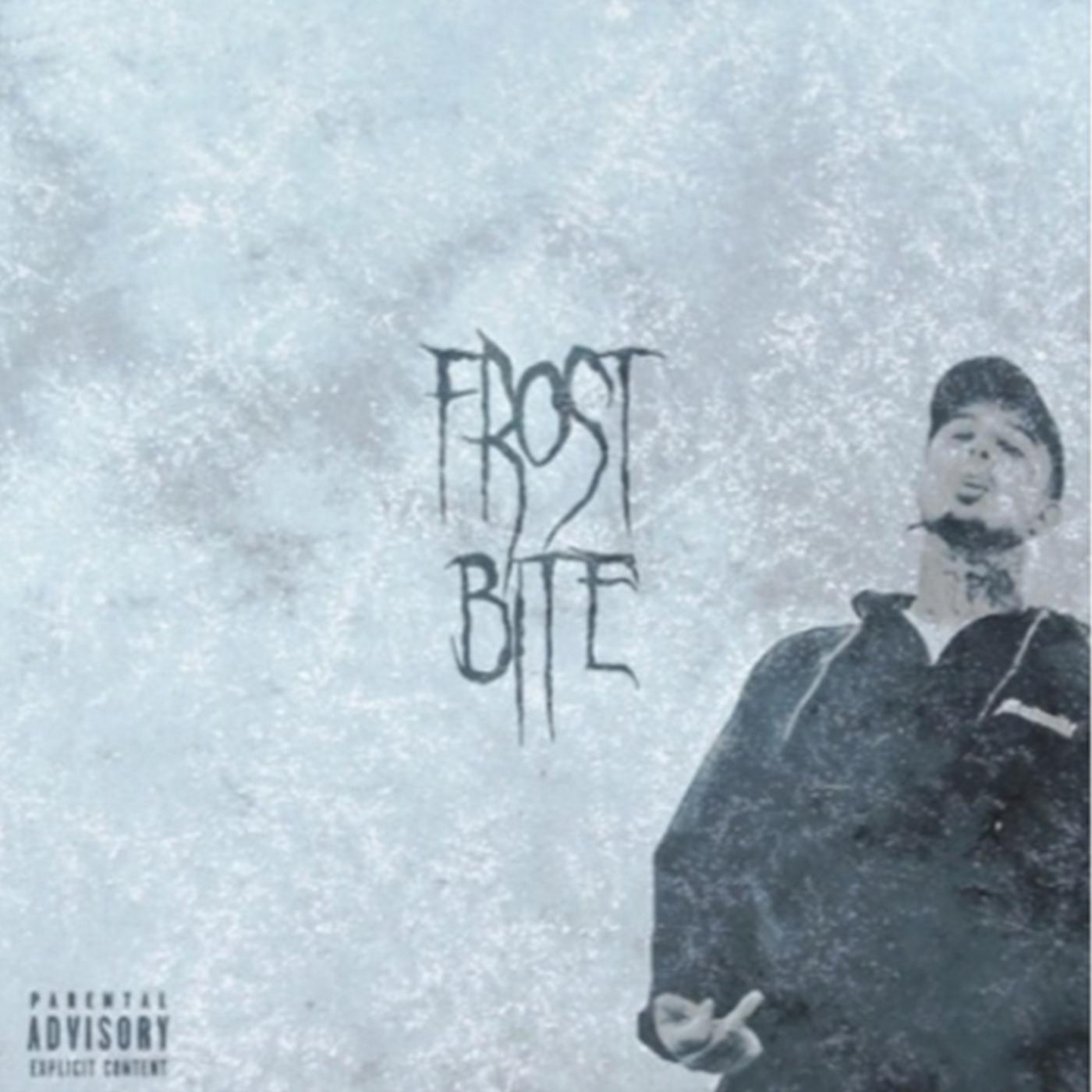 Frostbite