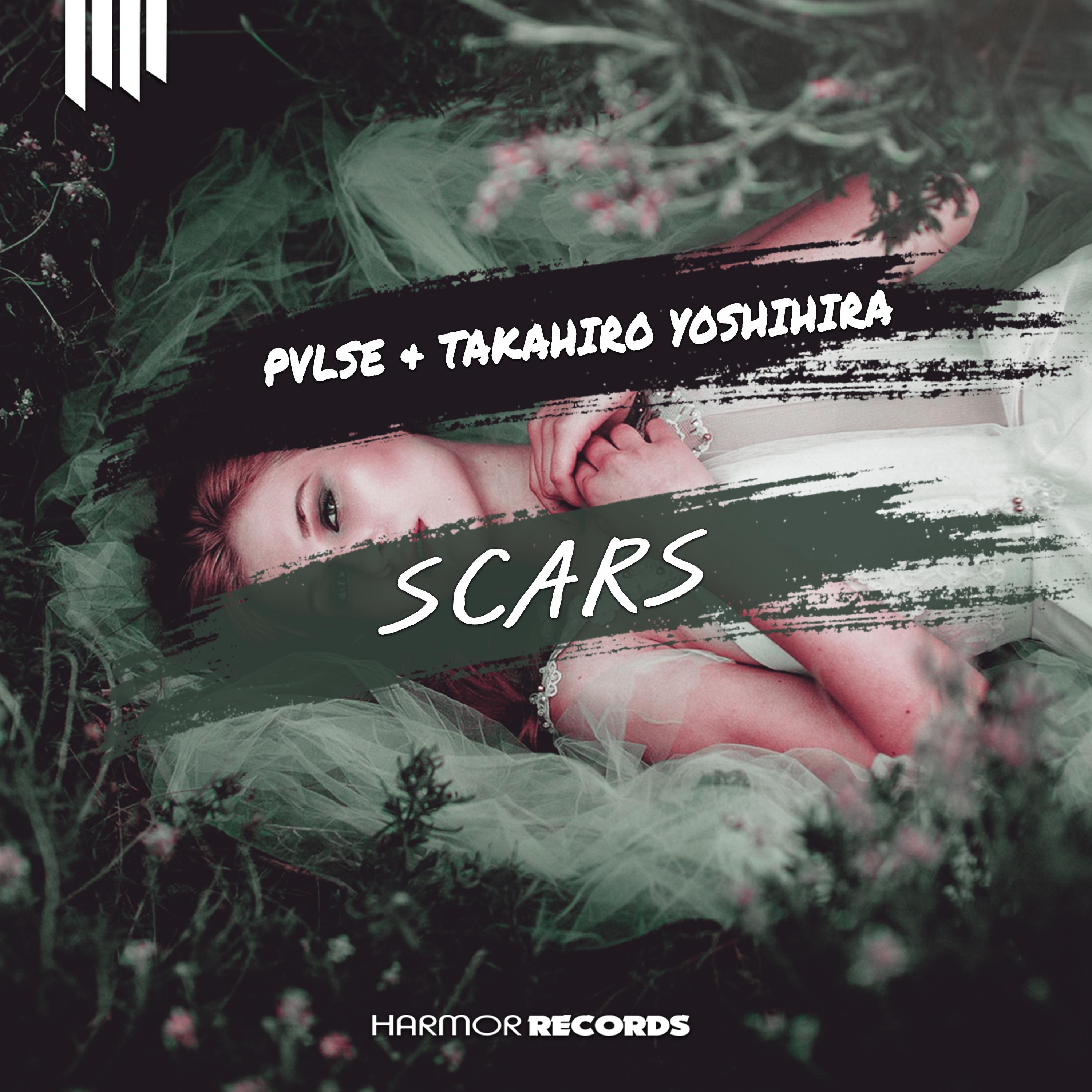 Scars