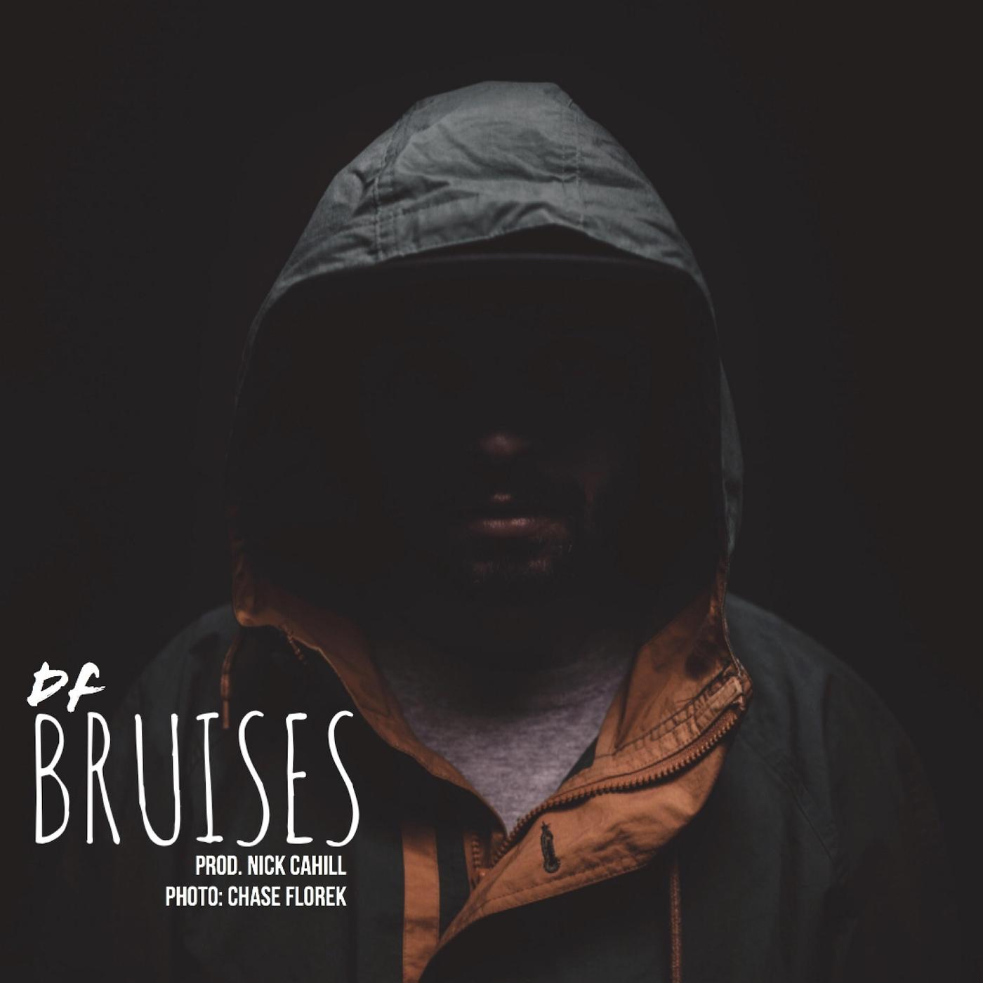 Bruises
