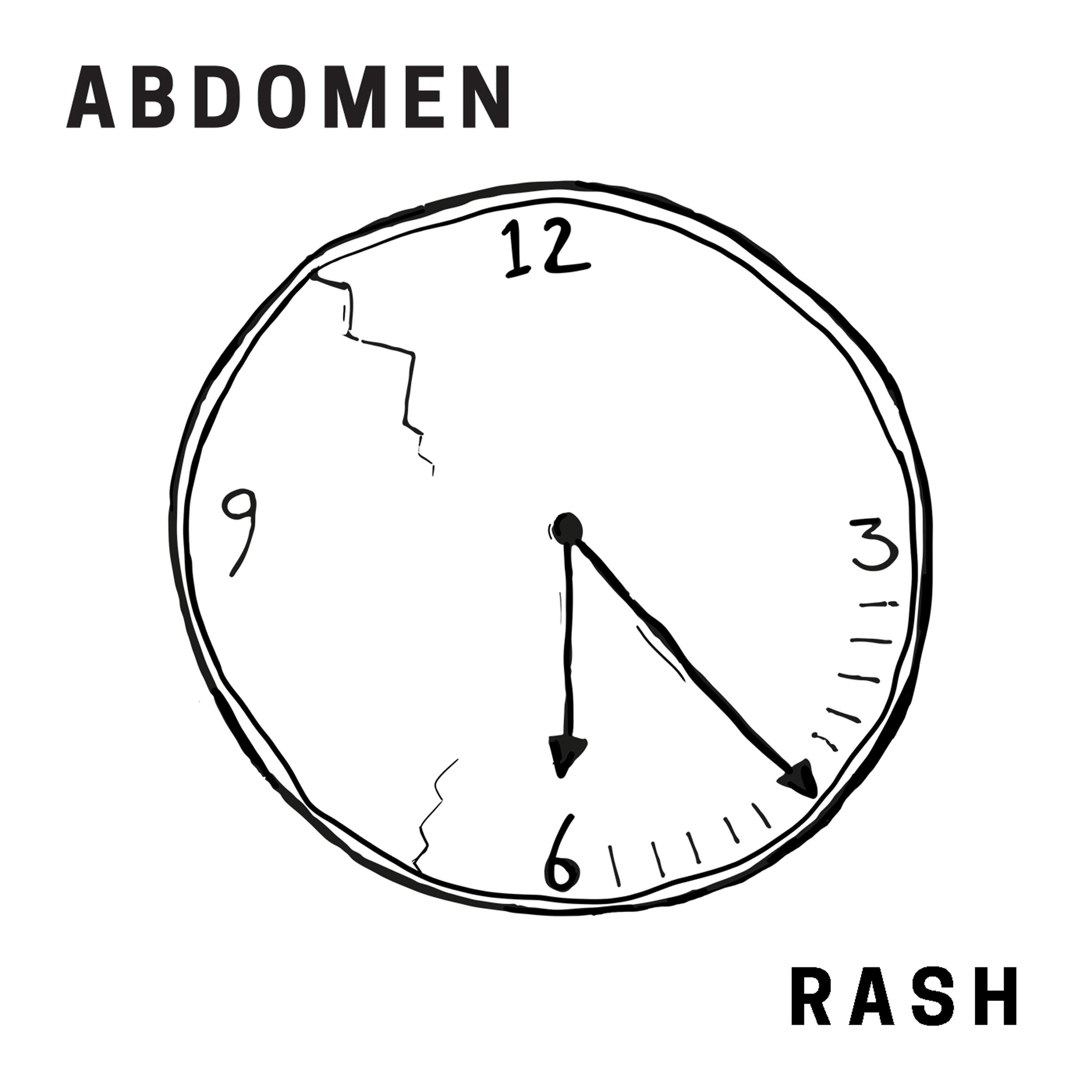 Rash