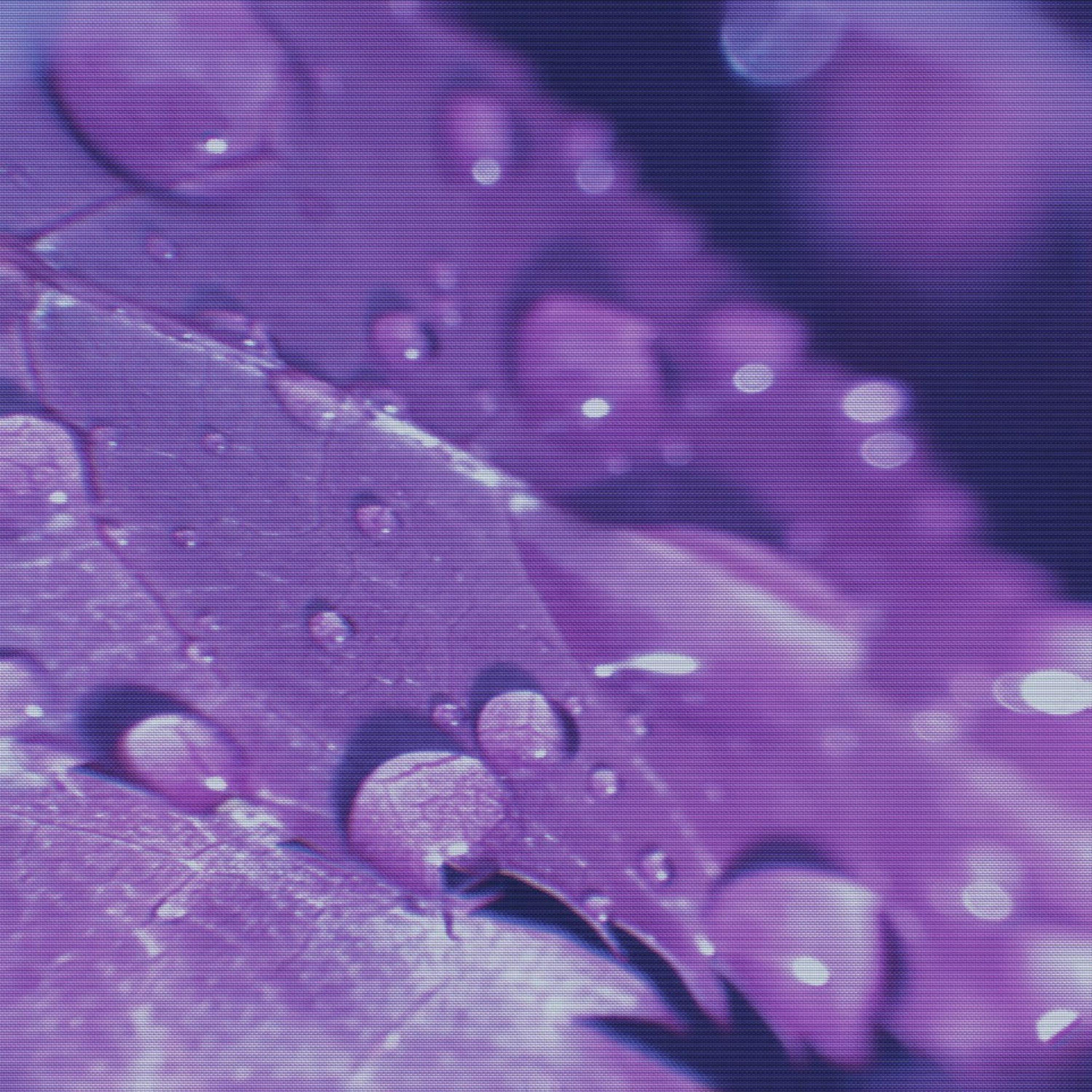Synthesis