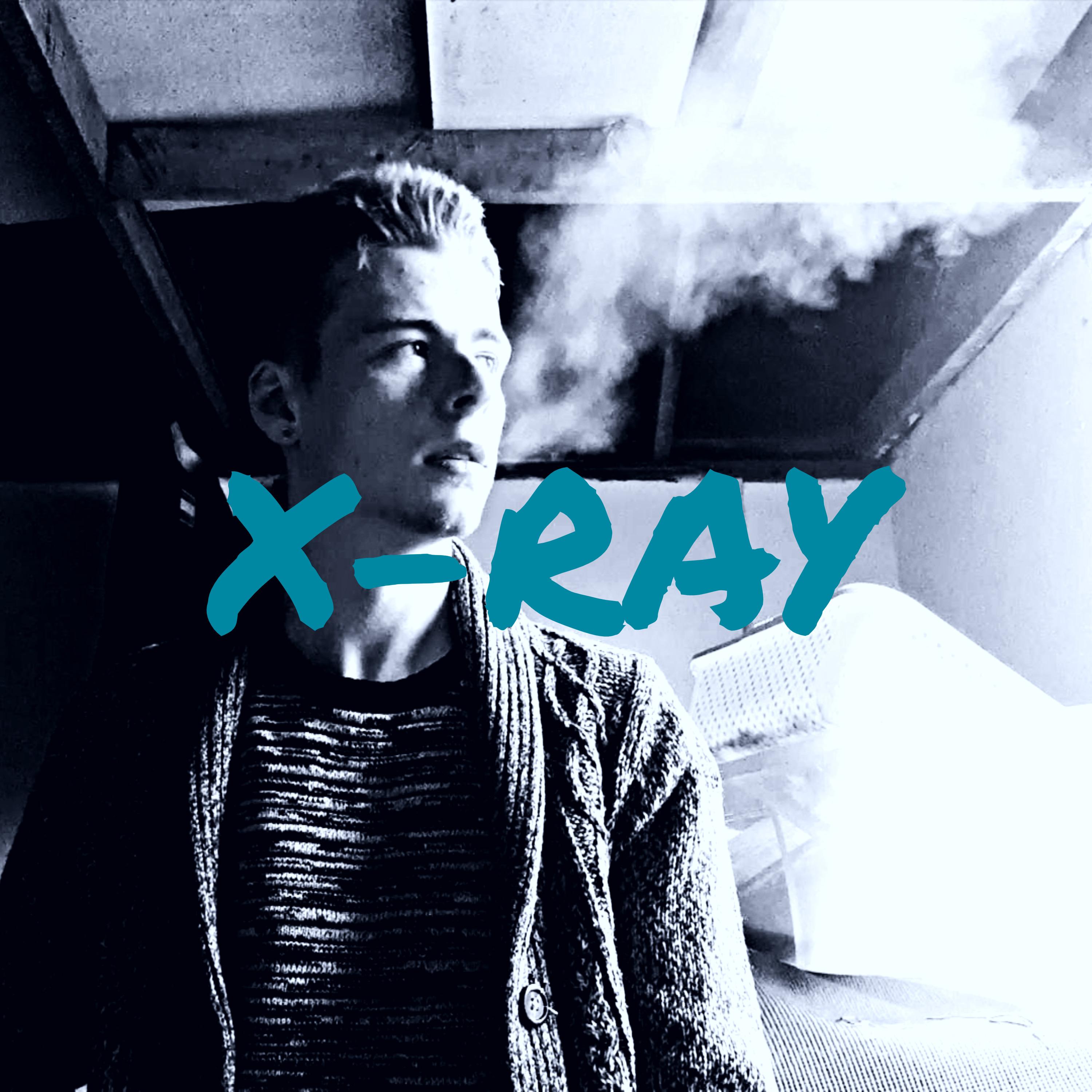 X-Ray