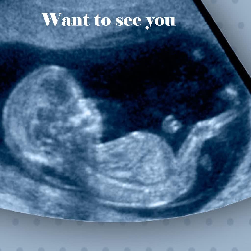 Want To See You