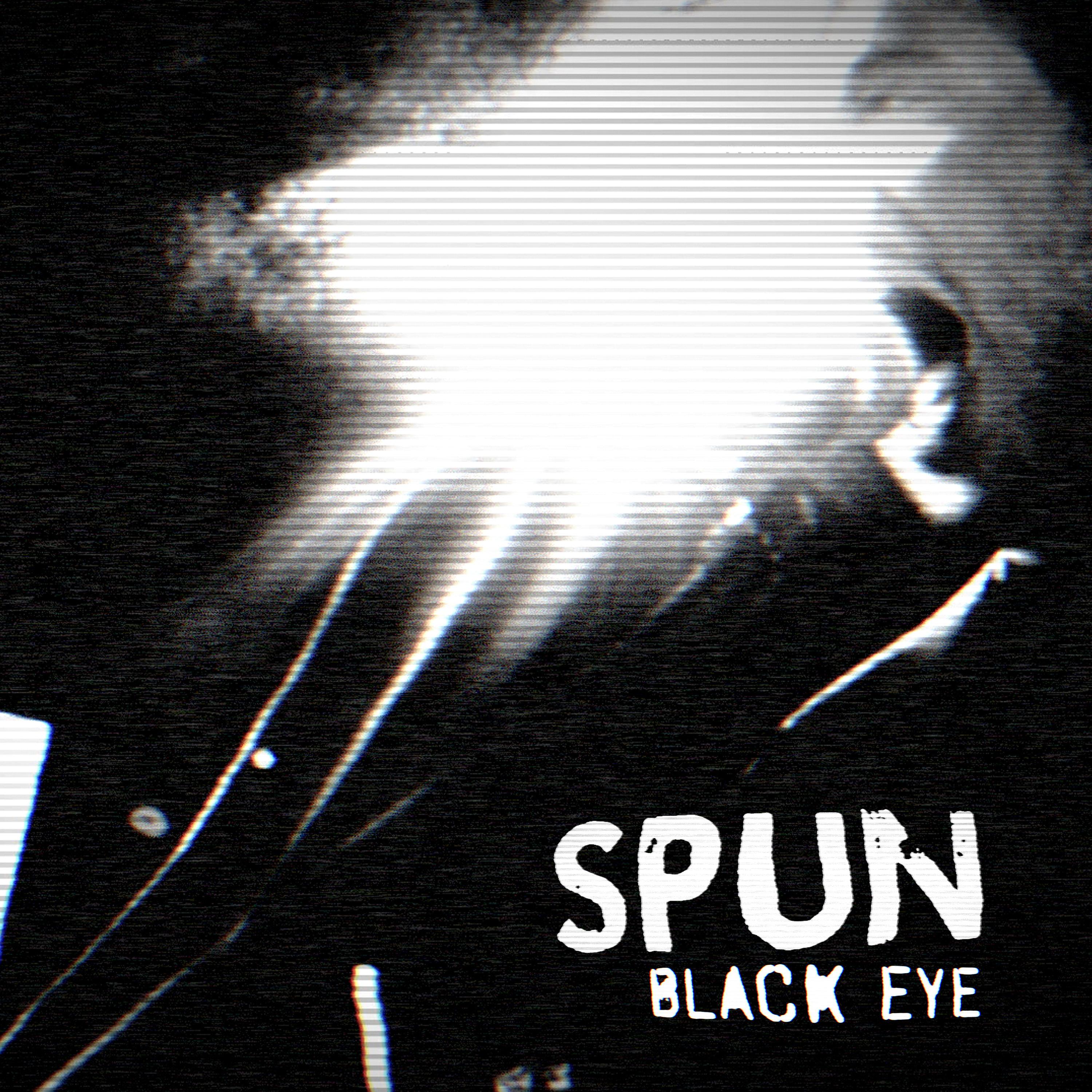 Black Eye