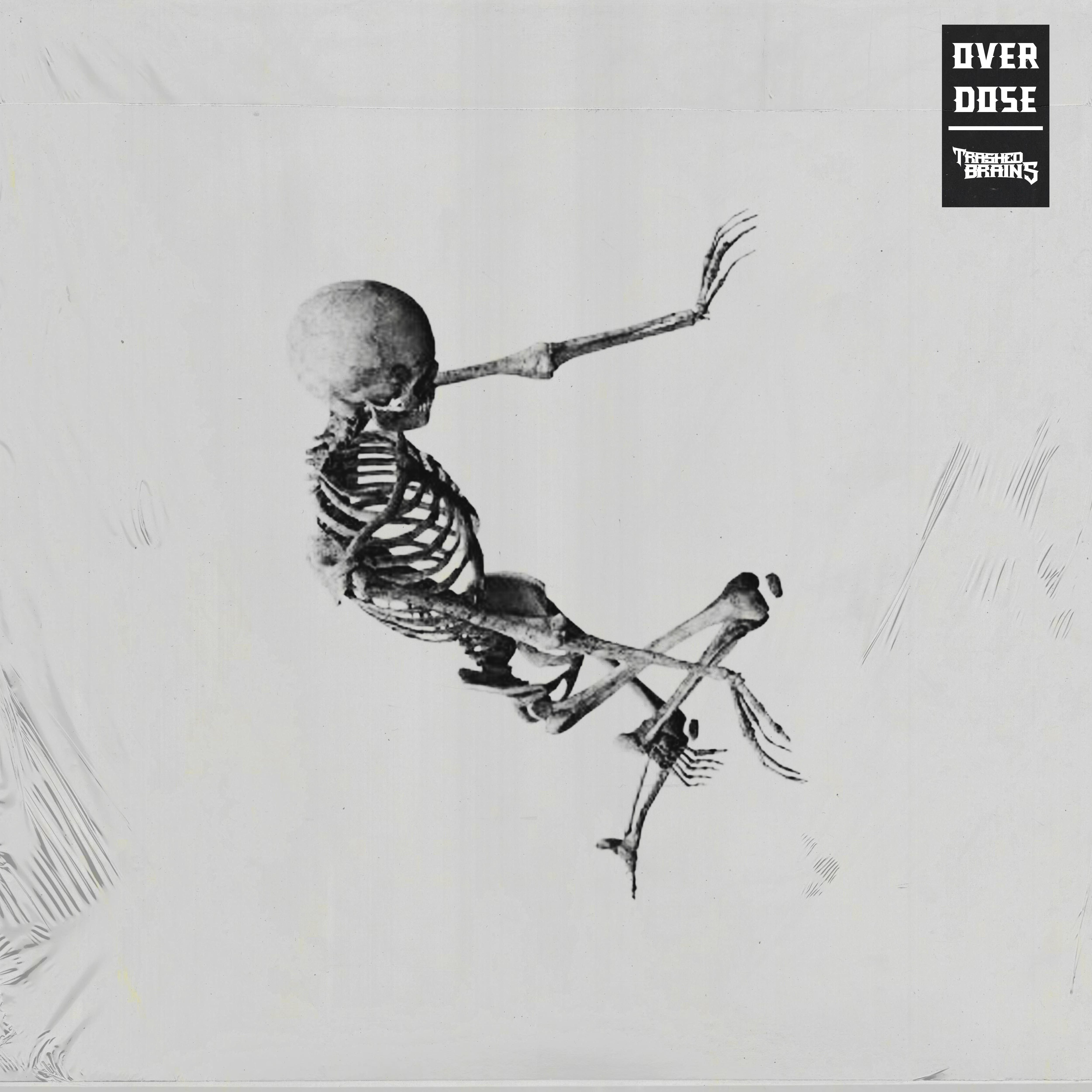 Overdose